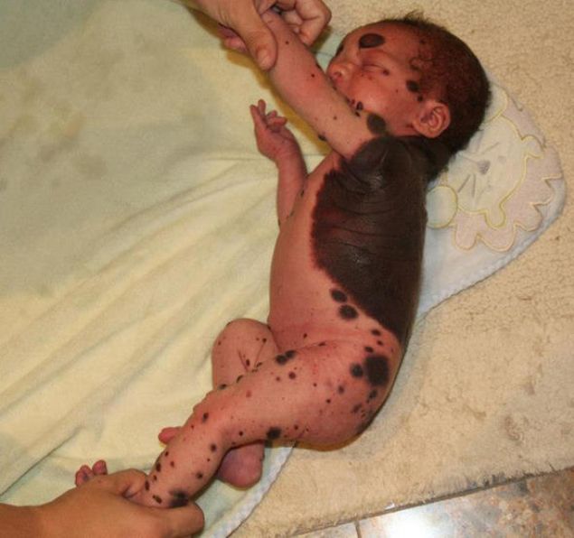  Doktorlar, Dylan��n annesi Kara�ya o�lunun birka� operasyon ge�irmesi gerekti�ini s�yledi.   