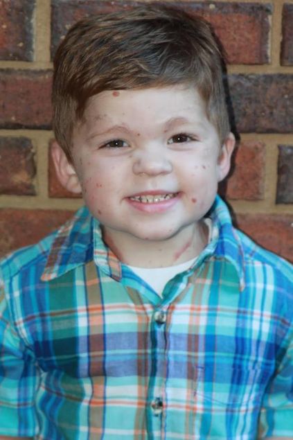  Buna ra�men, anne o�lunu hi�bir sosyal aktiviteden k�s�tlamad�.�O�lumla beraber d��ar�ya ��kmaktan �ekinmiyorum. Ona, utanacak bir �ey olmad���n� g�stermek istiyorum� dedi.  Haber: h�rriyet 