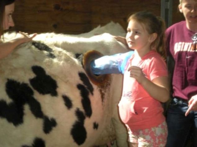  Darr Ziraat Merkezi'nden Do. Dr. Melissa Hudson'n anlattna gre bu yntem ilk olarak bir inekte deil, bir insanda uygulanmtr: Amerikan  Sava srasnda bir mermi, bir askerin midesini delmitir ve ne kadar uraldysa da yara olmas gerektii gibi kapanmamtr. Bunun zerine radikal bir karar alnarak hastann midesine kalc bir kanl taklmtr.      