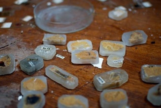   Ara�t�rma i�in balmumuyla kaplanm�� beyin par�alar�       