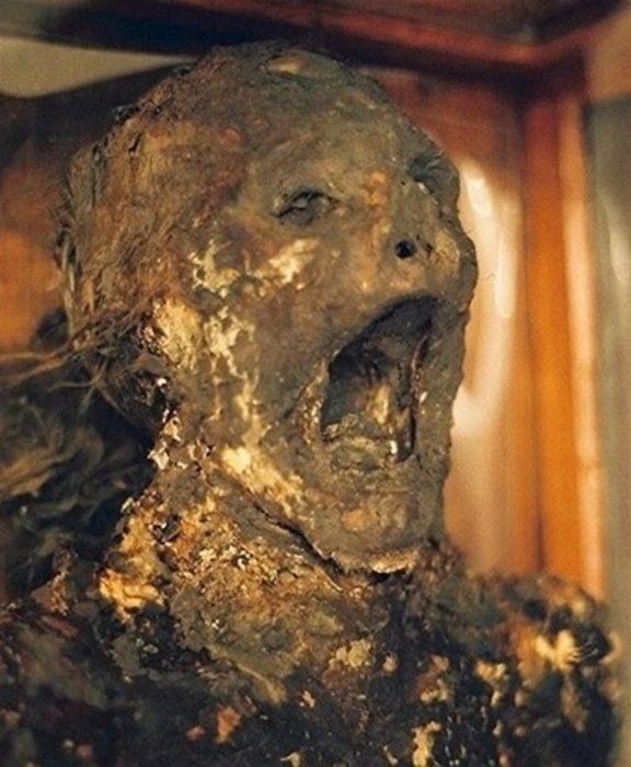  1800'lerde sar�hummadan �len bir kad�n.        