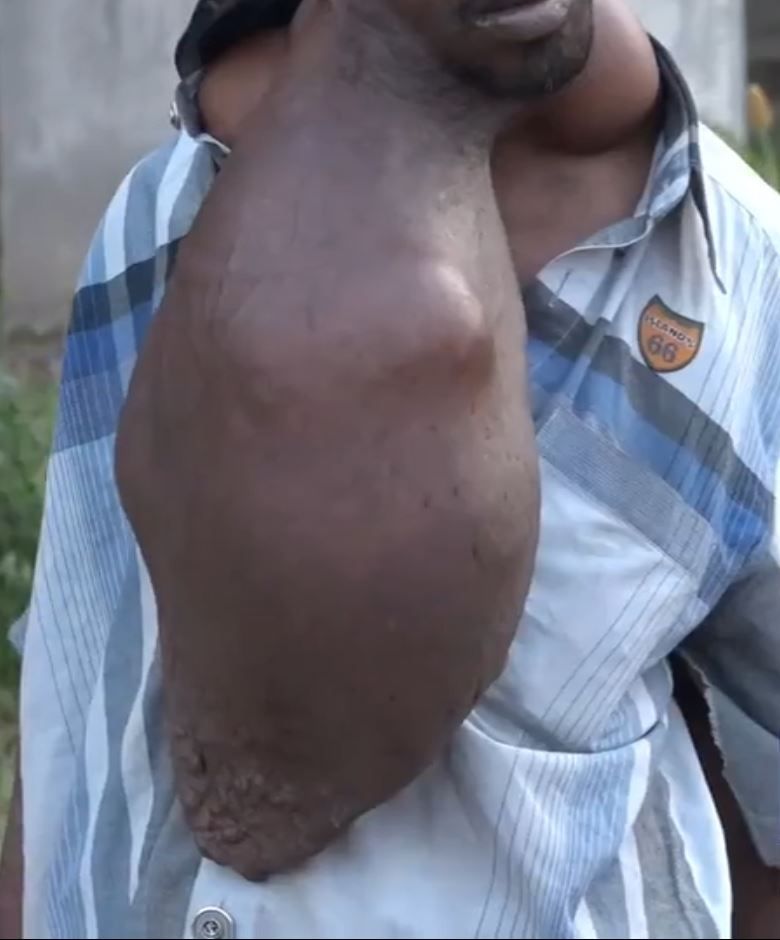 Ailesinin b�t�n �abalar�na ra�men devlet hastanelerinde iyile�tirilemedi.    