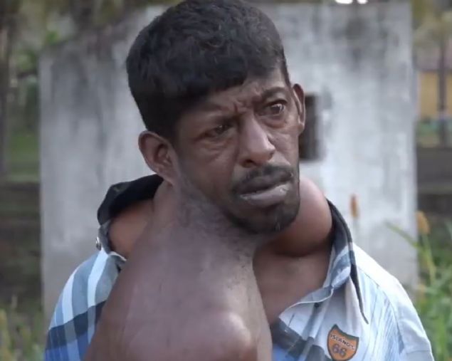  Talihsiz adam �uanda bir devlet hastanesinde g�zlem alt�nda ve doktorlar tedavisi i�in �i�itli testler yapmaktad�r.  Haber: star.com.tr 