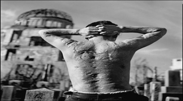                                                                 Hiro�ima Sald�r�s�ndan 20 y�l sonra bir yaral�n�n s�rt�.                                                                              