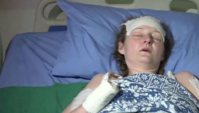                                                                 vlenip Suriyeye yerleen Ukrayna asll rina Barakat, 2016 ylnda evine bir bomba dmesi zerine bir kolunu kaybetti.                                                       