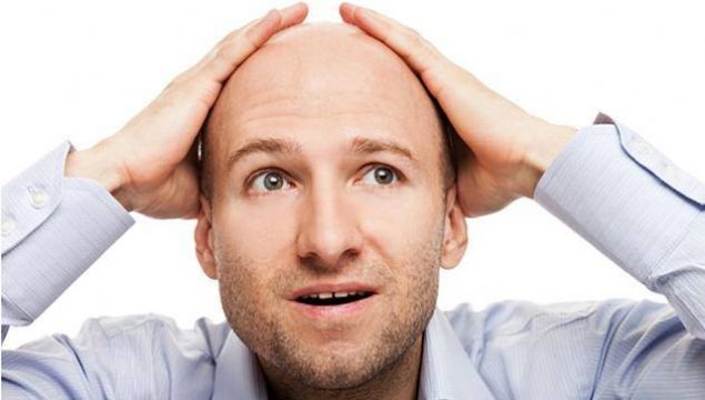                                                                     9- Peladofobi (kel insanlardan ya da kendisinin kel olmasndan korkma)                                                         