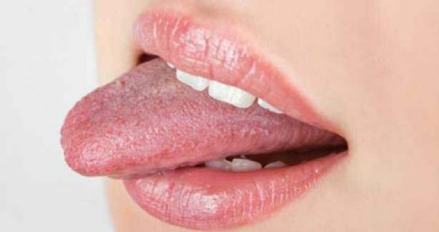 Her insann dilinin izi de parmak izi gibi farkldr.                      