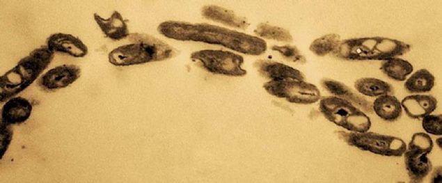 Ancak bu yeni ke�if, s�z konusu t�rdeki �ok say�da bakterinin b�lgede k�melendi�ini g�steriyor.   