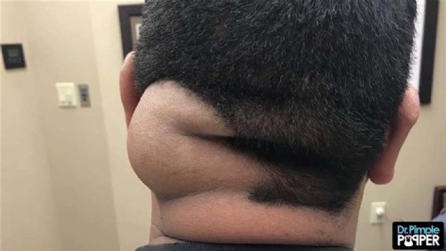 Operasyon ve operasyon sonras ise byk bir aknlk yaratt. 