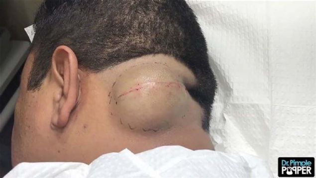 te ncesi ve sonrasyla o operasyon! 