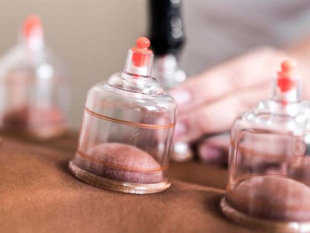 -Hacamat olmak, kan aldrmak, akupunktur kullanmak    