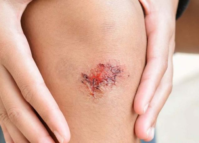 -Yaradan kan kan, irin ve benzerlerinin tekrar ieri girmesi   