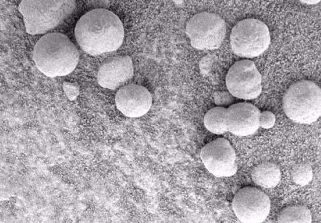 Foto�raftaki obje ilk bak��ta Orta�a�'da kullan�lan g�lleleri hat�rlat�yor.   <br><br>  Beynimiz, foto�raftaki nesnenin insan yap�m� (Ya da belki de uzayl� yap�m�!) bir top oldu�unu bize s�ylese de, muhtemelen bu yaln�zca, inan�lmaz a�amalardan ge�erek olu�mu� normal bir kaya.              