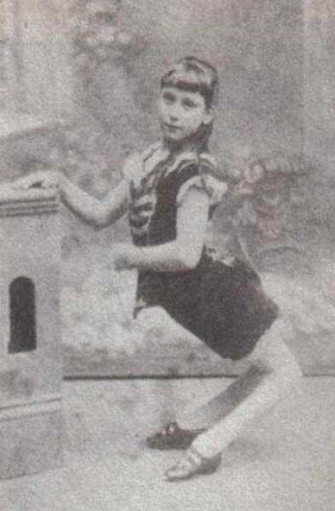 Ella Harper olarak da bilinen 'Deve Girl' Ella, bacaklar geriye eik olarak dodu.Ella, 1870 ile 1921 arasnda yaad.     