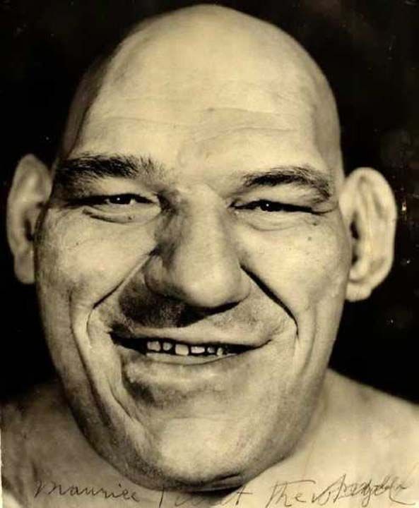 Tillet 17 yana geldiinde, ayaklar, elleri ve kafasnda orantsz bir byme ba gsteri ve kendisine akromegali -beyin tabannda bulunan hipofiz bezinin n lobundan (adenohipofiz) ok fazla miktarda byme hormonu (growth hormone, GH) salglanmas nedeniyle oluan hastalk- tehisi kondu.     