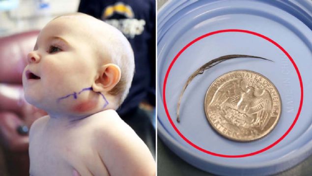 7 aylk bir bebek olan Mya Whittington tpk dier 7 aylk bebekler gibidir.  <br><br>  Bu zamanlarda enerjileri inanlmaz noktalara ulaan bebekler ilk kez grdkleri eylere dokunmadan edememektedirler. Kk Mya'nun anne babas da dier anne babalar gibi bebeklerinin zerine titremektedirler.    