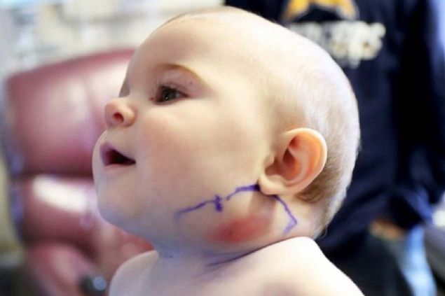 Kk bir tedaviden sonra kk Mya iyilemi ve bu sra d olay da aileye byk bir ders olmutur.  