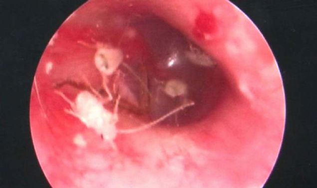 FoxNews'in haberine gre, in'in Sanh ehrinde 'Mr. L' olarak anlan 24 yandaki bir erkek, aile yelerinden, ardan kvrandran kulana k tutarak bakmasn istedi.     