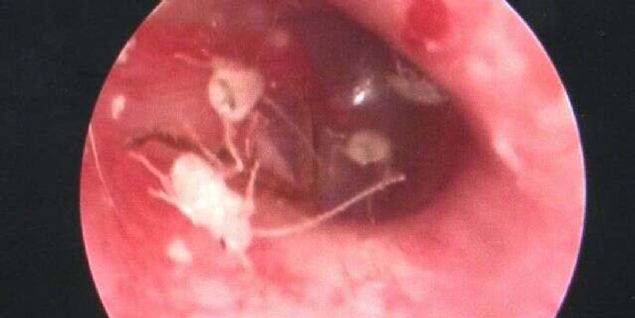 Hamam bceklerinin 'Mr. L'nn kulanda ne kadar sre yaad ise bilinmiyor. 