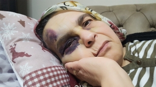 Vicdansızlık! Engelli kadını darp ettiler